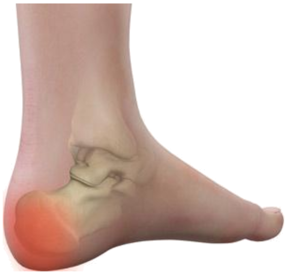 Varicose veins laser surgery- Jaju Clinic 