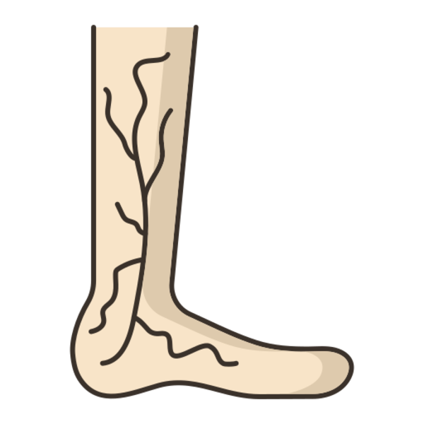 Varicose veins laser surgery- Jaju Clinic 